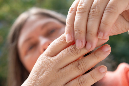 Close up of perimenopausal woman's hands showing dry skin