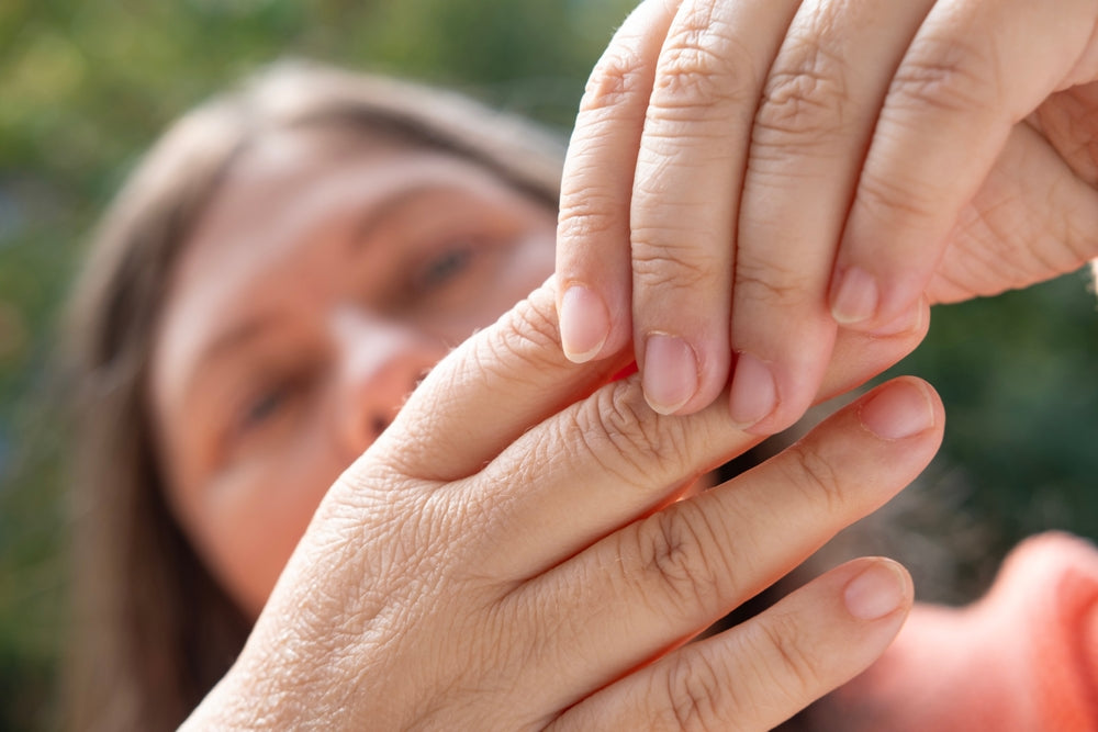 Close up of perimenopausal woman's hands showing dry skin